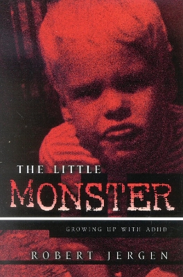 ibs