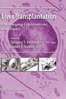 Liver Transplantation: Challenging Controversies and Topics - cover