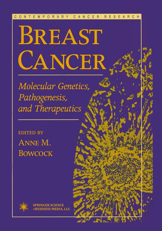 Breast Cancer