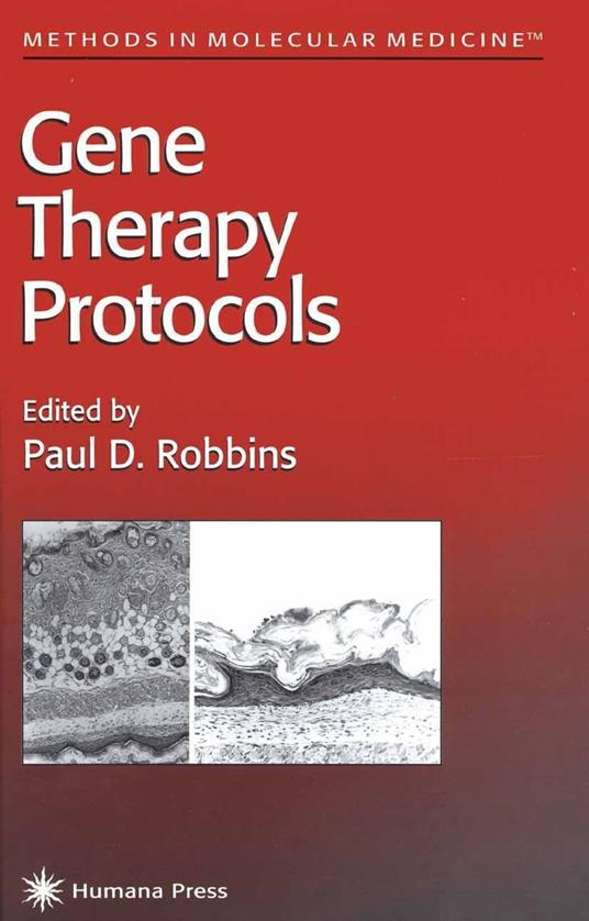 Gene Therapy Protocols