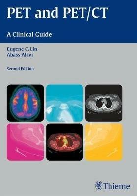 PET and PET/CT: A Clinical Guide - Abass Alavi - cover