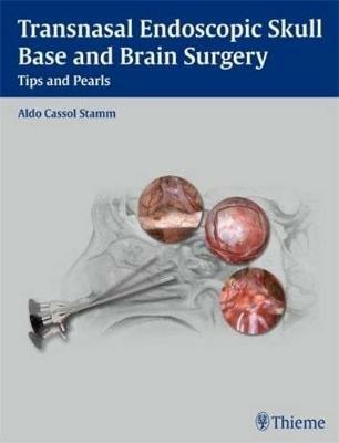 Transnasal Endoscopic Skull Base and Brain Surgery: Tips and Pearls - cover