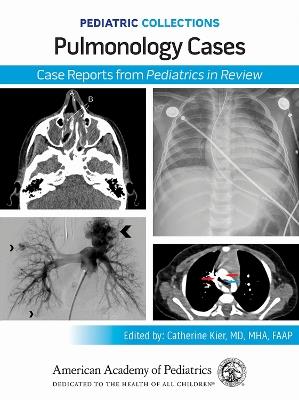 Pulmonology Cases: Case Reports from Pediatrics in Review - cover