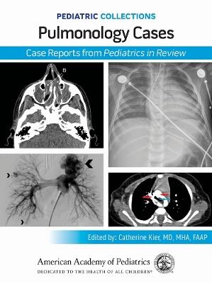 Pulmonology Cases: Case Reports from Pediatrics in Review - cover