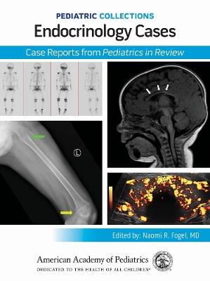 Endocrinology Cases: Case Reports from Pediatrics in Review - cover