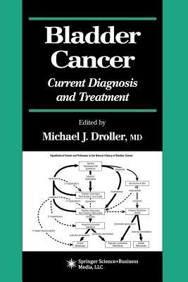 Bladder Cancer: Current Diagnosis and Treatment - cover