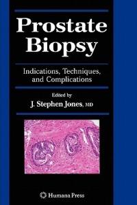 Prostate Biopsy: Indications, Techniques, and Complications - cover