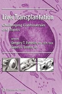 Liver Transplantation: Challenging Controversies and Topics - cover