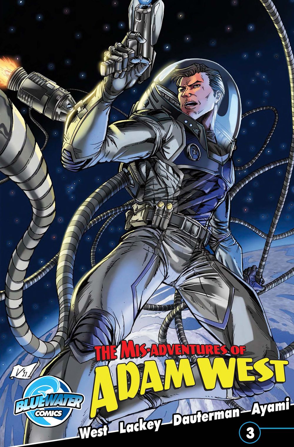 ibs