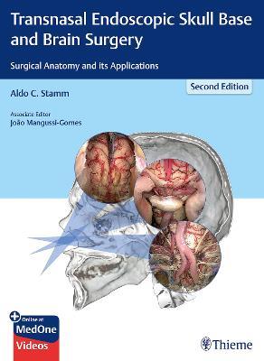 Transnasal Endoscopic Skull Base and Brain Surgery: Surgical Anatomy and its Applications - cover