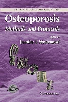 Osteoporosis: Methods and Protocols - cover
