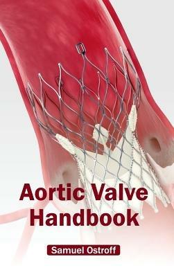 Aortic Valve Handbook - cover