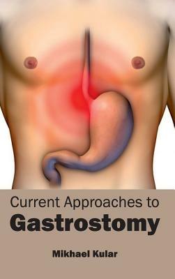 Current Approaches to Gastrostomy - cover