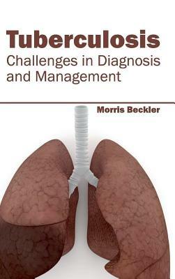Tuberculosis: Challenges in Diagnosis and Management - cover