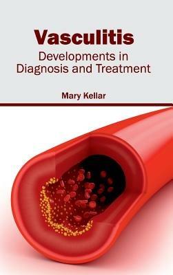 Vasculitis: Developments in Diagnosis and Treatment - cover