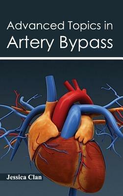 Advanced Topics in Artery Bypass - cover