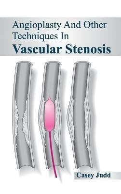 Angioplasty and Other Techniques in Vascular Stenosis - cover