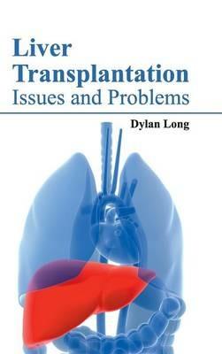 Liver Transplantation: Issues and Problems - cover
