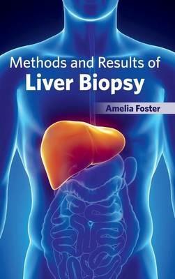 Methods and Results of Liver Biopsy - cover