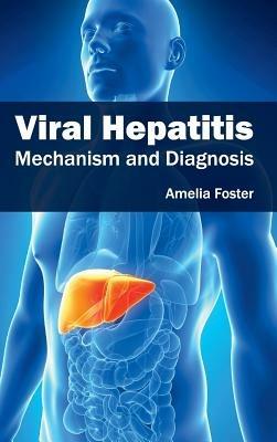 Viral Hepatitis: Mechanism and Diagnosis - cover