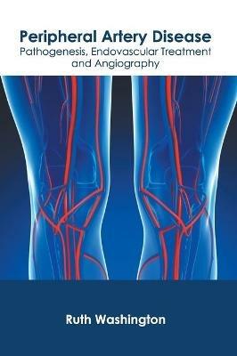 Peripheral Artery Disease: Pathogenesis, Endovascular Treatment and Angiography - cover