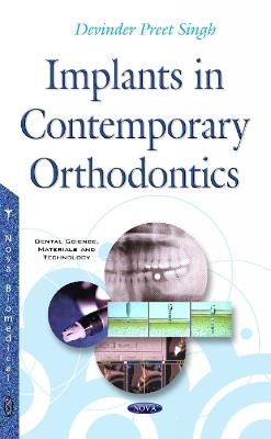 Implants in Contemporary Orthodontics - Devinder Preet - cover