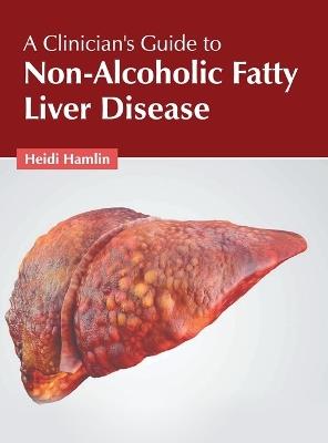 A Clinician's Guide to Non-Alcoholic Fatty Liver Disease - cover