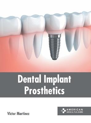 Dental Implant Prosthetics - cover