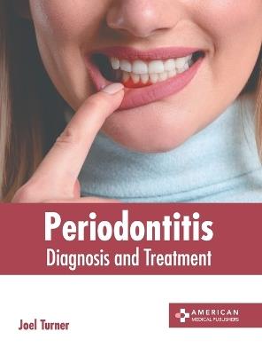 Periodontitis: Diagnosis and Treatment - cover