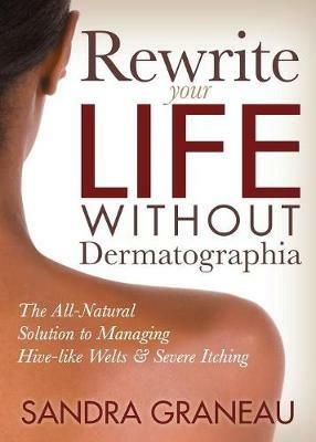 Rewrite Your Life Without Dermatographia: The All-Natural Solution to Managing Hive-like Welts and Severe Itching - Sandra Graneau - cover