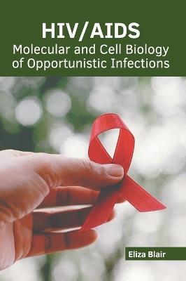 Hiv/Aids: Molecular and Cell Biology of Opportunistic Infections - cover