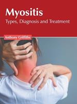 Myositis: Types, Diagnosis and Treatment