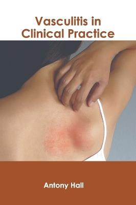 Vasculitis in Clinical Practice - cover