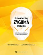 Understanding Zygoma Implants