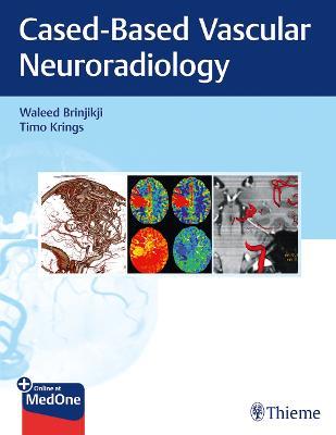 Imaging in Neurovascular Disease: A Case-Based Approach - Waleed Brinjikji,Timo Krings - cover