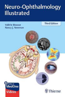 Neuro-Ophthalmology Illustrated - Valerie Biousse,Nancy Newman - cover
