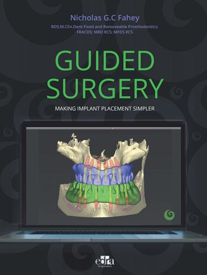 Guided surgery. Making implant placement simpler - Nicholas G.C. Fahey - copertina