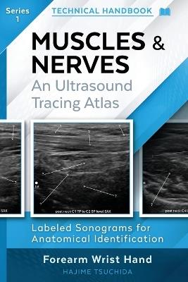 Technical Ultrasound Handbook - Muscles & Nerves: An Ultrasound Tracing Atlas (Series 1) - Hajime Tsuchida - cover