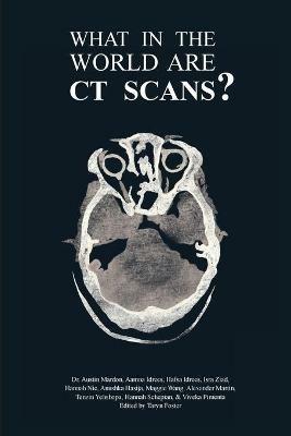 What in the World are CT Scans? - Austin Mardon,Aamna Idrees,Hafsa Idrees - cover