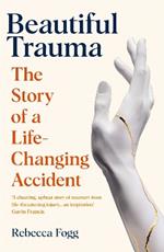 Beautiful Trauma: The Story of a Life-Changing Accident
