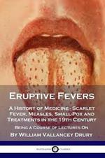 Eruptive Fevers: A History of Medicine - Scarlet Fever, Measles, Small-Pox and Treatments in the 19th Century - Being a Course of Lectures On