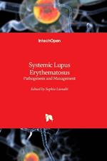 Systemic Lupus Erythematosus: Pathogenesis and Management