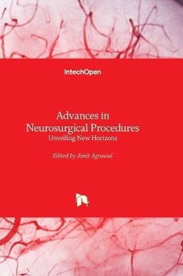 Advances in Neurosurgical Procedures - Unveiling New Horizons: Unveiling New Horizons - cover