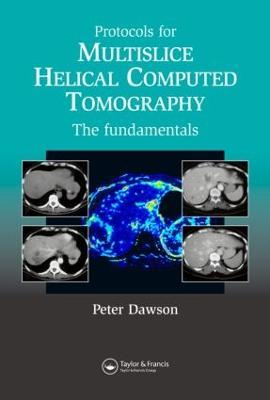 Protocols for Multislice Helical Computed Tomography: The Fundamentals - Dawson Peter - cover