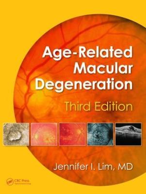 Age-Related Macular Degeneration, Third Edition - cover