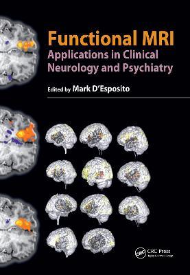 Functional MRI: Applications in Clinical Neurology and Psychiatry - cover