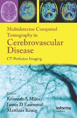 Multidetector Computed Tomography in Cerebrovascular Disease: CT Perfusion Imaging - cover