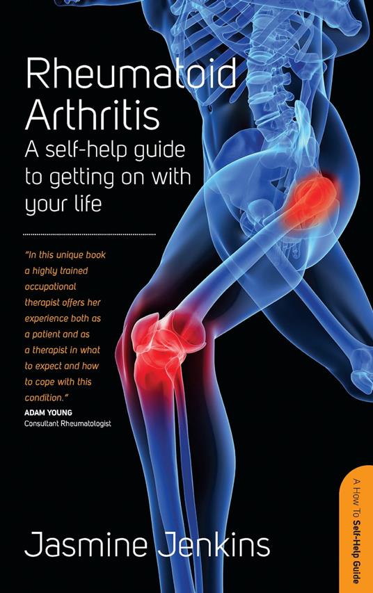 Rheumatoid Arthritis