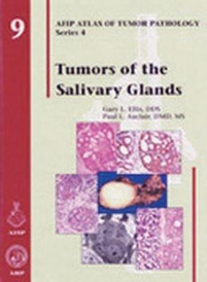 Tumors of the Salivary Glands - Gary L. Ellis,Paul L. Auclair - cover