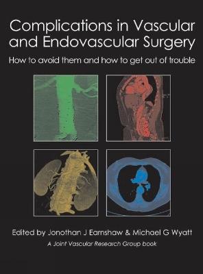 Complications in Vascular and Endovascular Surgery: How to avoid them and how to get out of trouble - cover
